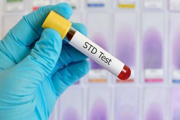 HIV & STDs Treatment in Delhi